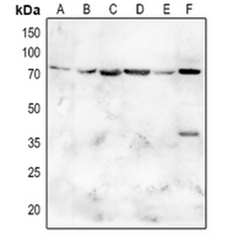 Anti-SGLT2 Antibody