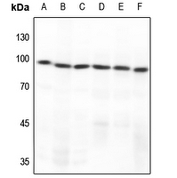 Anti-GCFC2 Antibody