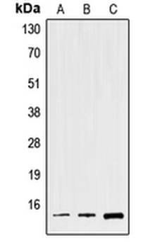 Anti-Spasmolysin Antibody
