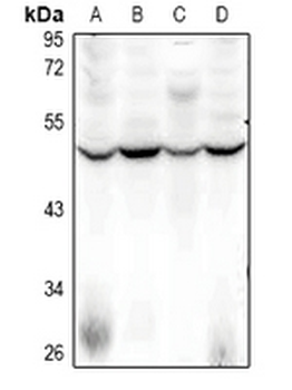 Anti-SFRS11 Antibody