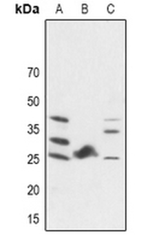 Anti-FGF19 Antibody