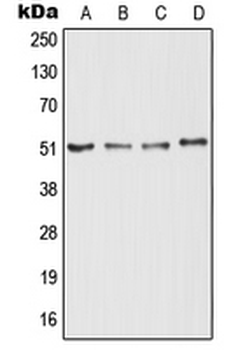 Anti-RTN4R Antibody