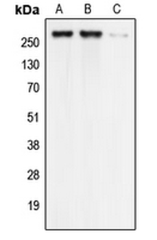 Anti-Cav3.1 Antibody