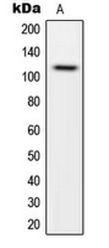 Anti-CARD14 Antibody