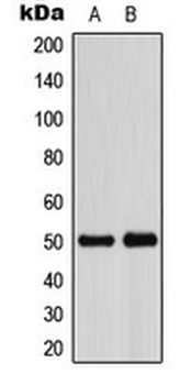 Anti-ADPGK Antibody