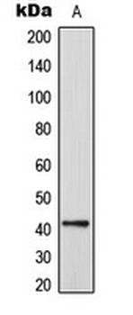 Anti-CEP41 Antibody