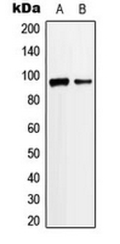 Anti-ANKRD20A3 Antibody