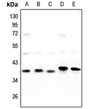 Anti-CK1 alpha Antibody