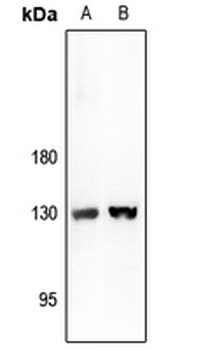 Anti-ARHGAP20 Antibody