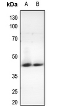 Anti-Nocturnin Antibody