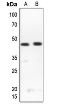 Anti-RPL3L Antibody