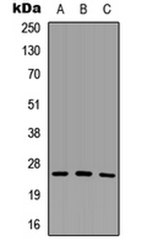 Anti-SCNM1 Antibody