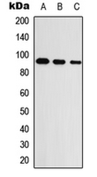 Anti-UNC5A Antibody