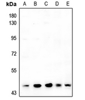 Anti-ARRDC4 Antibody