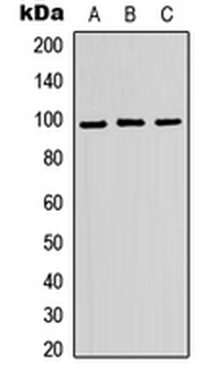 Anti-ATP6V0A2 Antibody