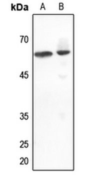 Anti-DGK epsilon Antibody