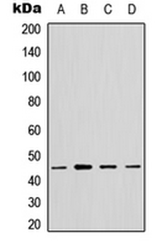 Anti-GTPBP5 Antibody