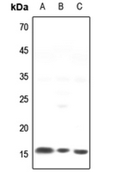 Anti-NCALD Antibody