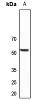 Anti-PLXDC1 Antibody