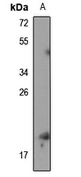 Anti-RPS19BP1 Antibody