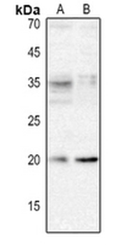 Anti-XCL1 Antibody
