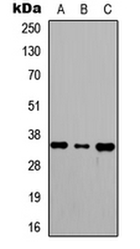 Anti-RagA/B Antibody