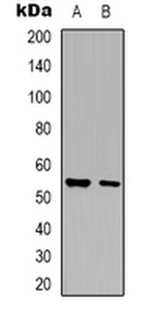 Anti-Glycerate Kinase Antibody