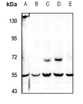 Anti-PKE Antibody