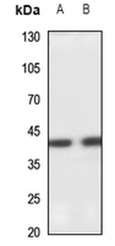 Anti-SETMAR Antibody