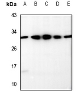 Anti-RRP7A/B Antibody