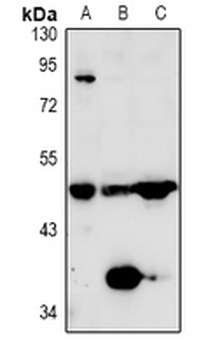 Anti-TAFI Antibody