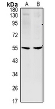 Anti-CCDC102A Antibody