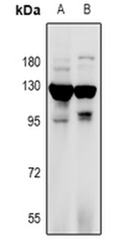 Anti-RANBP17 Antibody