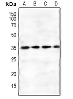 Anti-FKSG1 Antibody