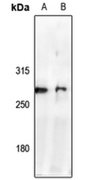 Anti-NAV2 Antibody
