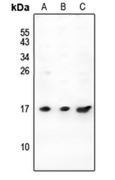 Anti-PIGY Antibody