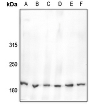 Anti-Nav1.2 Antibody