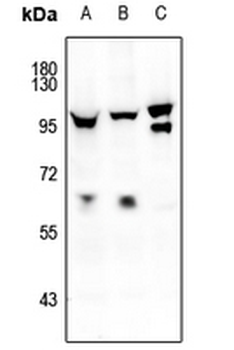 Anti-FOXO1/3/4 (pT24/32) Antibody