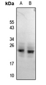 Anti-RGS1/8/16 (pY187/159/168) Antibody