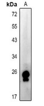 Anti-RAB15 Antibody
