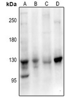 Anti-EPHB1/2/3 Antibody