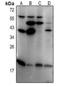 Anti-MXD4 Antibody