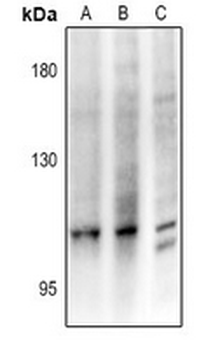 Anti-CCP3 Antibody