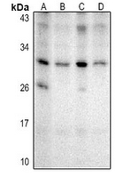 Anti-NKX2-8 Antibody