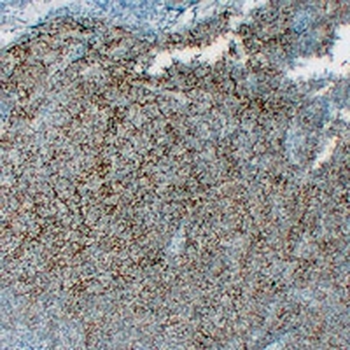 Anti-CD35 Antibody
