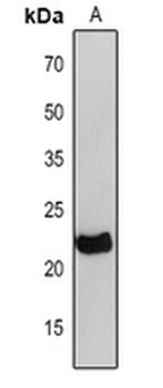 Anti-petC Antibody