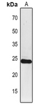 Anti-PSAF Antibody