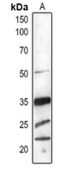 Anti-PSBO1/2 Antibody