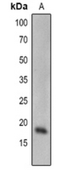 Anti-SCE1 Antibody