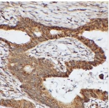 TSG101 Mouse Monoclonal Antibody